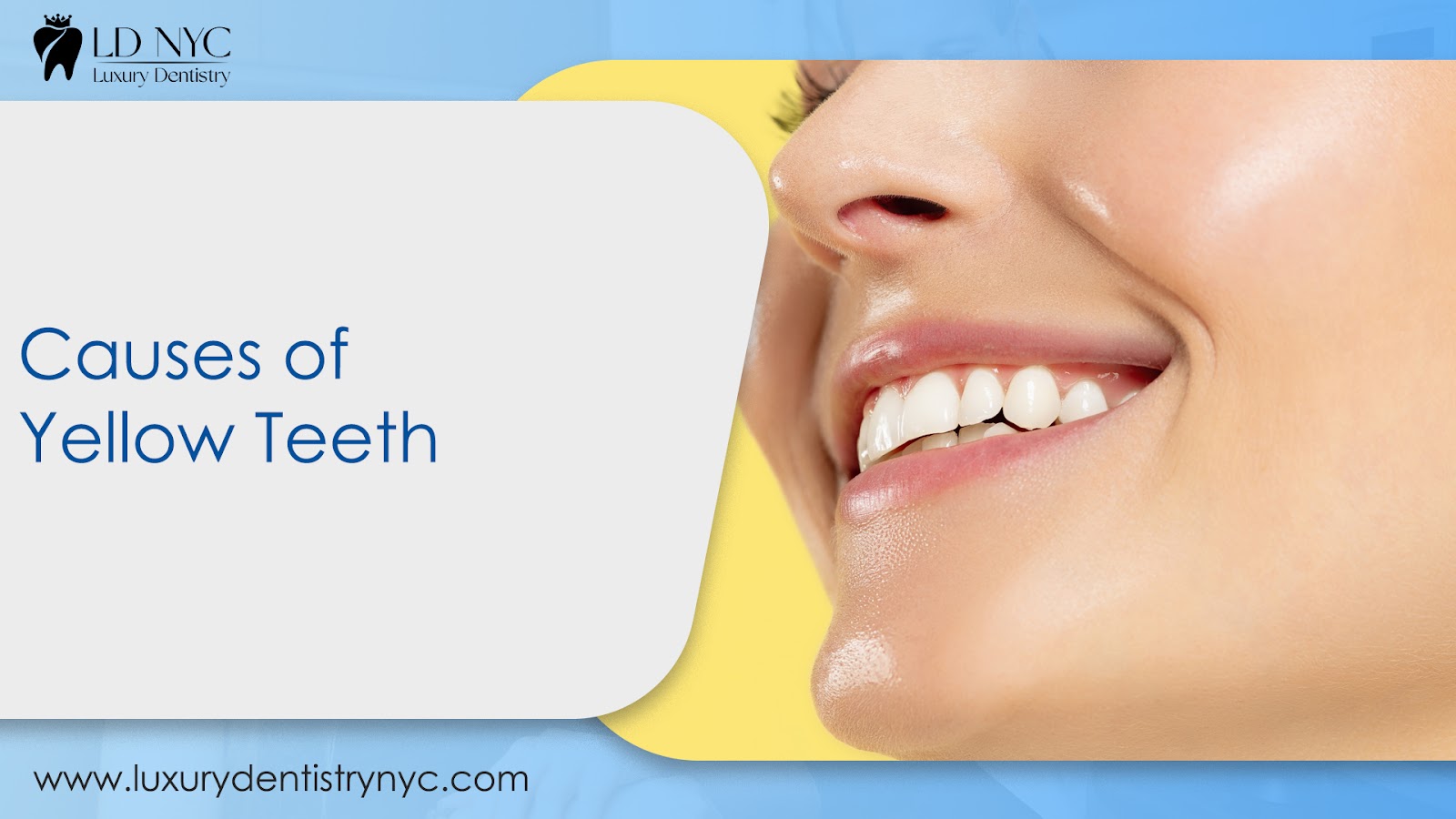 Causes of Yellow Teeth