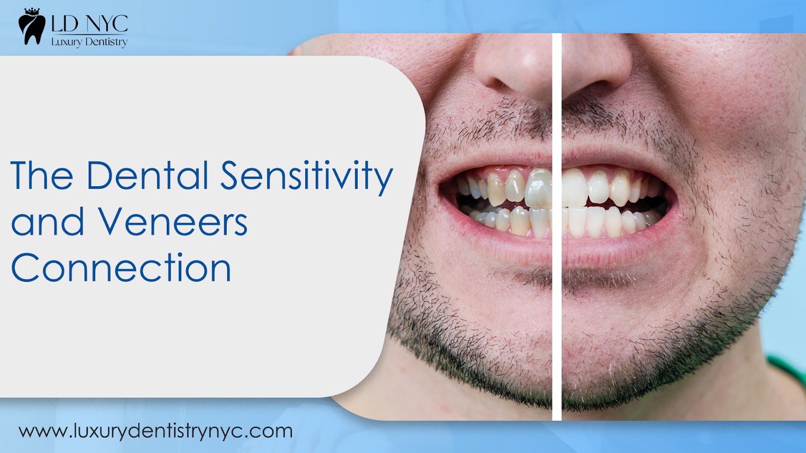 The Dental Sensitivity and Veneers Connection