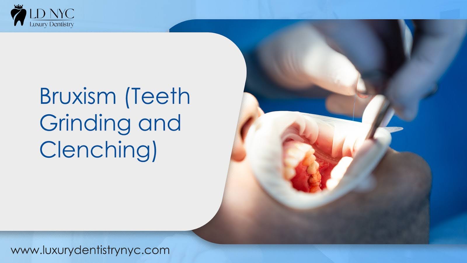 Bruxism (Teeth Grinding and Clenching)
