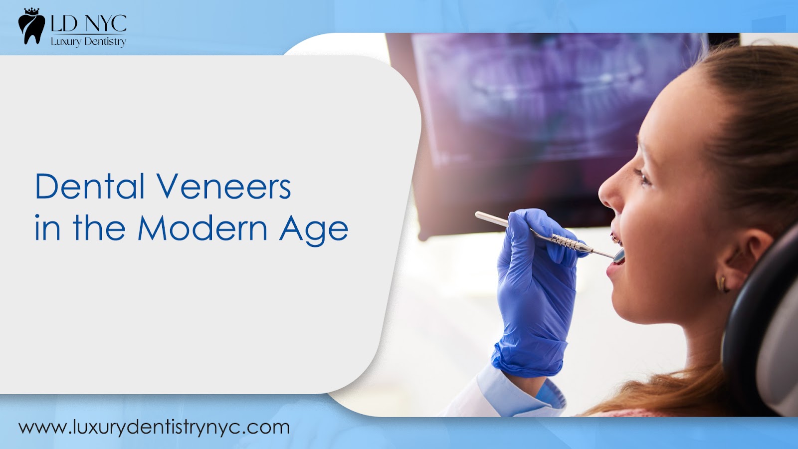 Dental Veneers in the Modern Age