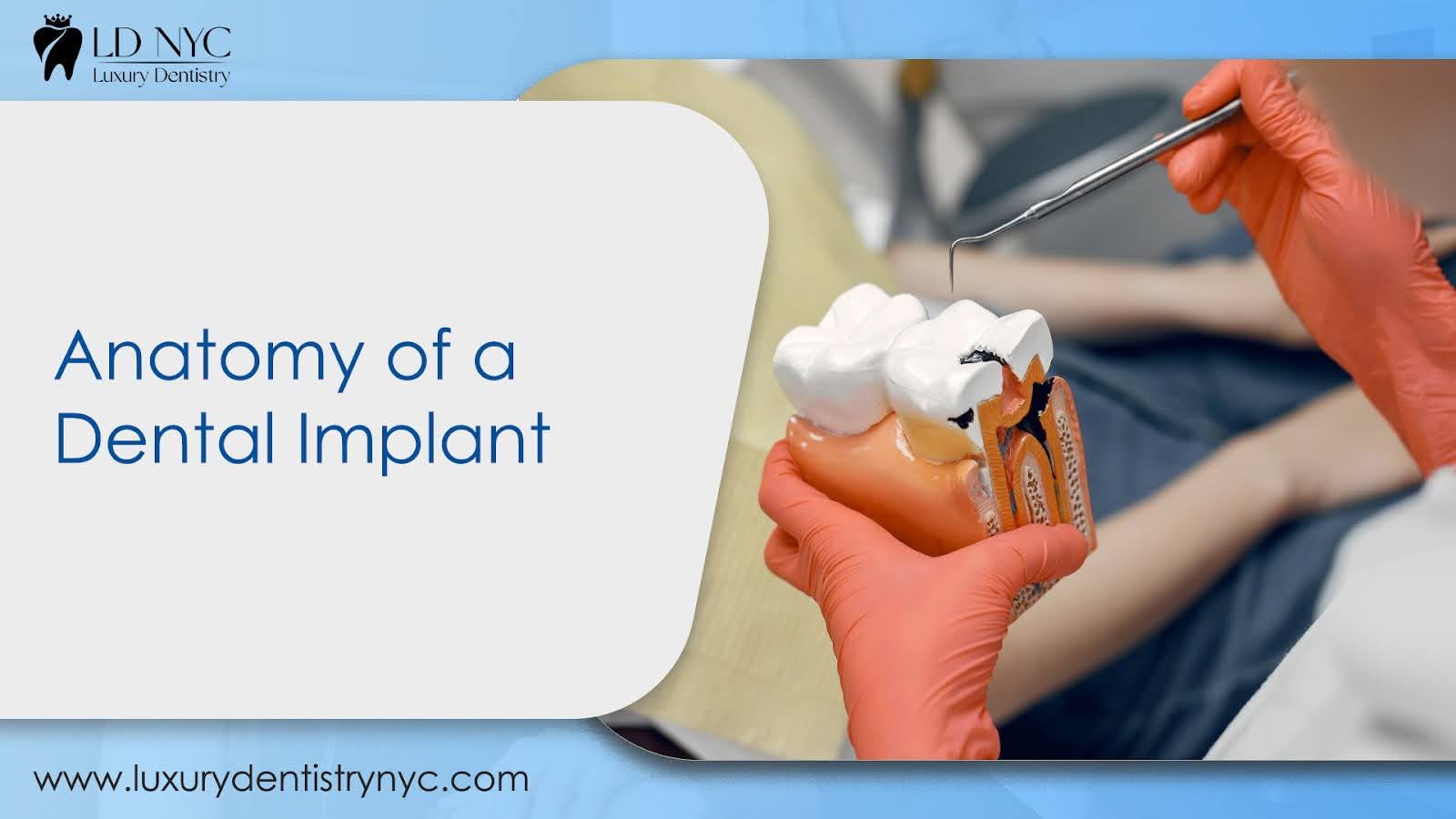 Anatomy of a Dental Implant